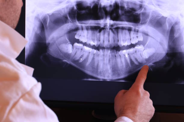 Best Emergency Dental Care for Abscessed Tooth in Edgeworth, PA