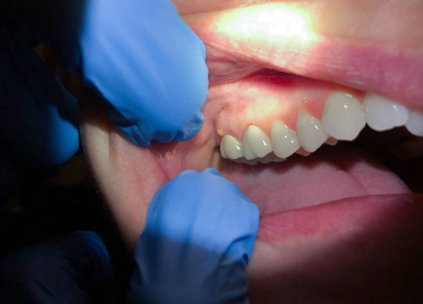 Best Emergency Root Canal Treatment in Edgeworth, PA